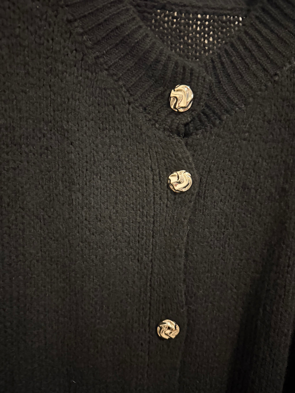 Cardigan Oversize – Manches Bouffantes & Boutons